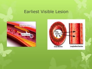 Earliest Visible Lesion
 