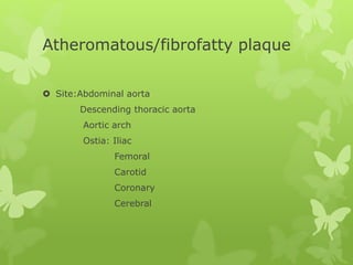 Atheromatous/fibrofatty plaque
 Site:Abdominal aorta
Descending thoracic aorta
Aortic arch
Ostia: Iliac
Femoral
Carotid
Coronary
Cerebral
 