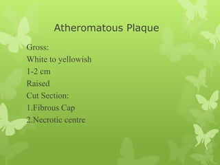 Atheromatous Plaque
Gross:
White to yellowish
1-2 cm
Raised
Cut Section:
1.Fibrous Cap
2.Necrotic centre
 