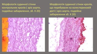 Atherosclerosis Slide 31
