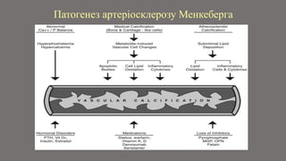 Atherosclerosis Slide 6