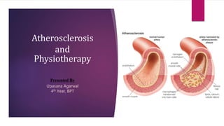 Atherosclerosis
and
Physiotherapy
Presented By
Upasana Agarwal
4th Year, BPT
 