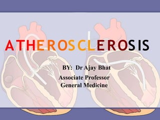 ATHEROSCLEROSIS
BY: Dr Ajay Bhat
Associate Professor
General Medicine
 