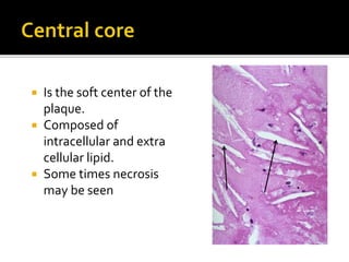  Is the soft center of the
plaque.
 Composed of
intracellular and extra
cellular lipid.
 Some times necrosis
may be seen
 