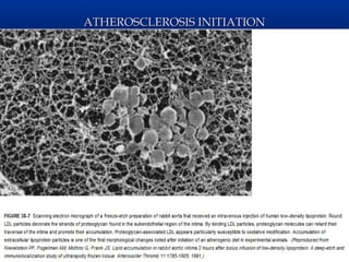 ATHEROSCLEROSIS INITIATION
 