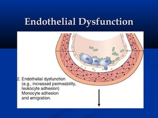 Endothelial Dysfunction
 