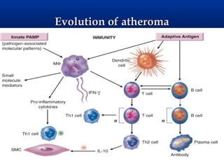 Evolution of atheroma
 