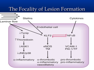The Focality of Lesion Formation
 