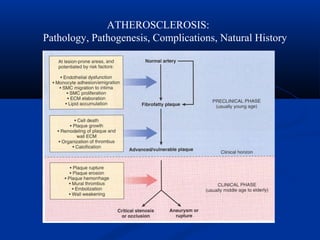 ATHEROSCLEROSIS:
Pathology, Pathogenesis, Complications, Natural History
 