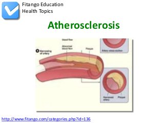 Fitango Education
          Health Topics

                      Atherosclerosis




http://www.fitango.com/categories.php?id=136
 