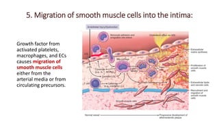 5. Migration of smooth muscle cells into the intima:
Growth factor from
activated platelets,
macrophages, and ECs
causes migration of
smooth muscle cells
either from the
arterial media or from
circulating precursors.
 