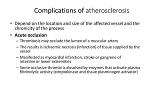 Complications of atherosclerosis
• Depend on the location and size of the affected vessel and the
chronicity of the process
• Acute occlusion
– Thrombosis may occlude the lumen of a muscular artery
– The results is ischaemic necrosis (infarction) of tissue supplied by the
vessel
– Manifested as myocardial infarction, stroke or gangrene of
intestine or lower extremities
– Some occlusive thrombi is dissolved by enzymes that activate plasma
fibrinolytic activity (streptokinase and tissue plasminogen activator)
 