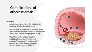Complications of
atherosclerosis
• Embolism
• A thrombus formed over the plaque may
detach and lodge in a distal vessel
• Embolization from a thrombus in abdominal
aortic aneurysm may acutely occlude popliteal
artery, with subsequent gangrene of leg
• Ulceration of the plaque may also
dislodge atheromatous debris and
produce “cholesterol crystal emboli”
(appear as needle-shaped spaces in
tissue; most common in kidney)
 