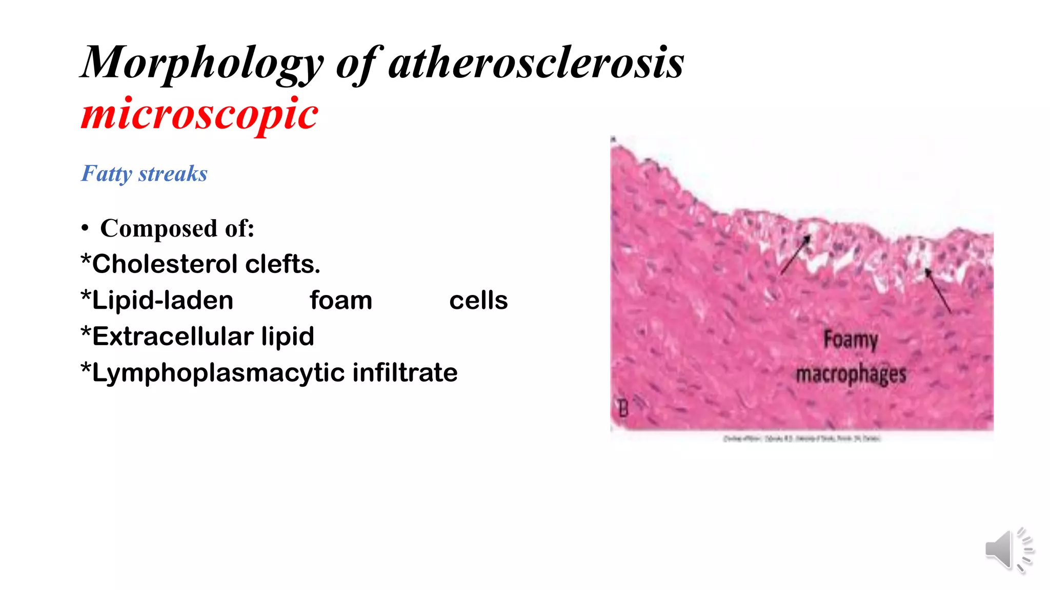pathology of Atherosclerosis, dissection and aneurysm copy | PPT