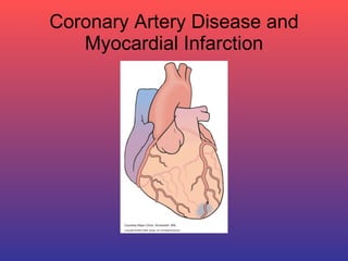 Coronary Artery Disease and Myocardial Infarction 