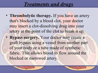 Treatments and drugs
• Thrombolytic therapy. If you have an artery 
that's blocked by a blood clot, your doctor 
may insert a clot-dissolving drug into your 
artery at the point of the clot to break it up.
• Bypass surgery. Your doctor may create a 
graft bypass using a vessel from another part 
of your body or a tube made of synthetic 
fabric. This allows blood to flow around the 
blocked or narrowed artery.

 