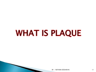 BY :- NATHANI ZEESHAN M. 11
 