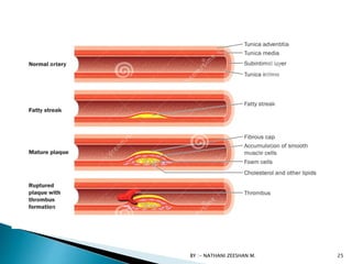 BY :- NATHANI ZEESHAN M. 25
 