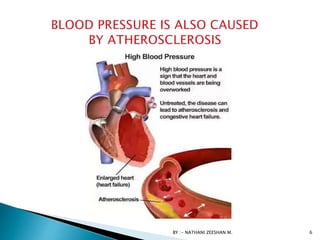 BY :- NATHANI ZEESHAN M. 6
 