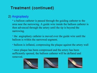 Compressing A Balloon Athersclerosis and angina صفاء | PPT