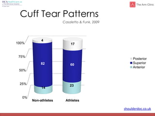 shoulderdoc.co.uk
Cuff Tear Patterns
Non-athletes Athletes
0%
25%
50%
75%
100%
14
23
82 60
4
17
Posterior
Superior
Anterior
Casaletto & Funk, 2009
 