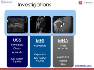 shoulderdoc.co.uk
USS
Immediate
Cheap
Accurate
Not assoc.
injuries
MRI
Accessible
Expensive
Not assoc.
injuries
MRA
Most
Accurate
Expensive
Access
Skills
Investigations
 