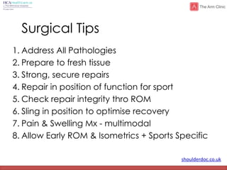 shoulderdoc.co.uk
Surgical Tips
1. Address All Pathologies
2. Prepare to fresh tissue
3. Strong, secure repairs
4. Repair in position of function for sport
5. Check repair integrity thro ROM
6. Sling in position to optimise recovery
7. Pain & Swelling Mx - multimodal
8. Allow Early ROM & Isometrics + Sports Specific
 