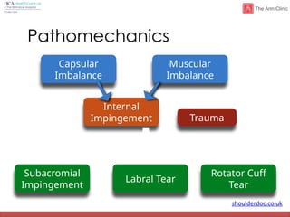 shoulderdoc.co.uk
Pathomechanics
Capsular
Imbalance
Muscular
Imbalance
Internal
Impingement Trauma
+/-
Labral Tear
Subacromial
Impingement
Rotator Cuff
Tear
+
{
 