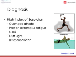 shoulderdoc.co.uk
Diagnosis
• High Index of Suspicion
– Overhead athlete
– Pain on extremes & fatigue
– GIRD
– Cuff Signs
– Ultrasound Scan
 