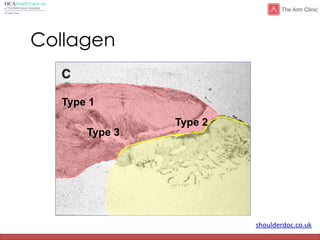 shoulderdoc.co.uk
Collagen
Type 1
Type 2
Type 3
 