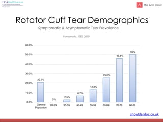 shoulderdoc.co.uk
Rotator Cuff Tear Demographics
Symptomatic & Asymptomatic Tear Prevalence
Yamamoto, JSES, 2010
 