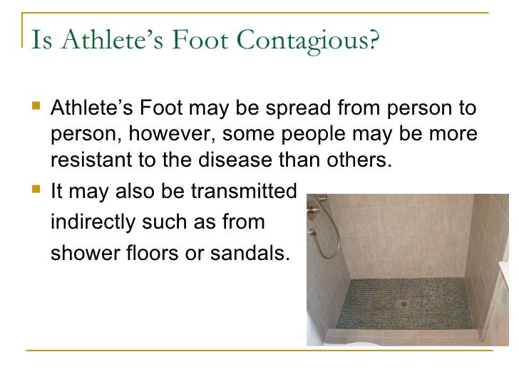 Athlete’s Foot