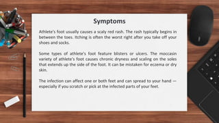 Symptoms
Athlete's foot usually causes a scaly red rash. The rash typically begins in
between the toes. Itching is often the worst right after you take off your
shoes and socks.
Some types of athlete's foot feature blisters or ulcers. The moccasin
variety of athlete's foot causes chronic dryness and scaling on the soles
that extends up the side of the foot. It can be mistaken for eczema or dry
skin.
The infection can affect one or both feet and can spread to your hand —
especially if you scratch or pick at the infected parts of your feet.
 