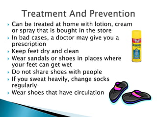    Can be treated at home with lotion, cream
    or spray that is bought in the store
   In bad cases, a doctor may give you a
    prescription
   Keep feet dry and clean
   Wear sandals or shoes in places where
    your feet can get wet
   Do not share shoes with people
   If you sweat heavily, change socks
    regularly
   Wear shoes that have circulation
 