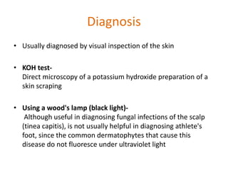 Diagnosis 
• Usually diagnosed by visual inspection of the skin 
• KOH test- 
Direct microscopy of a potassium hydroxide preparation of a 
skin scraping 
• Using a wood's lamp (black light)- 
Although useful in diagnosing fungal infections of the scalp 
(tinea capitis), is not usually helpful in diagnosing athlete's 
foot, since the common dermatophytes that cause this 
disease do not fluoresce under ultraviolet light 
 