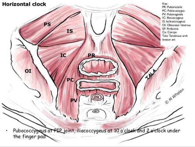 Male Pelvic Floor Dysfunction In Elite Sport