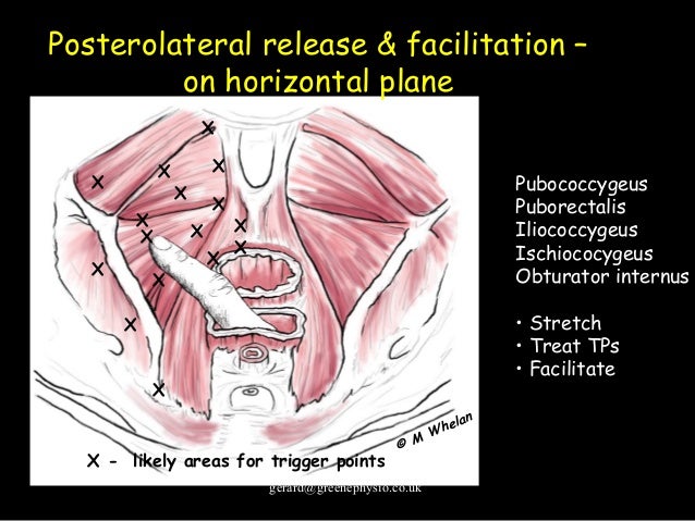 Male Pelvic Floor Dysfunction In Elite Sport