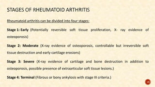 Rheumatoid arthritis can be divided into four stages:
Stage 1: Early (Potentially reversible soft tissue proliferation, X- ray evidence of
osteoporosis)
Stage 2: Moderate (X-ray evidence of osteoporosis, controllable but irreversible soft
tissue destruction and early cartilage erosions)
Stage 3: Severe (X-ray evidence of cartilage and bone destruction in addition to
osteoporosis, possible presence of extraarticular soft tissue lesions.)
Stage 4: Terminal (Fibrous or bony ankylosis with stage III criteria.)
13
 