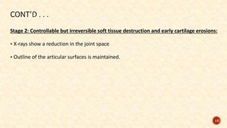 Stage 2: Controllable but irreversible soft tissue destruction and early cartilage erosions:
 X-rays show a reduction in the joint space
 Outline of the articular surfaces is maintained.
15
 