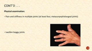 Physical examination:
Pain and stiffness in multiple joints (at least four, metacarpophalangeal joints)
swollen boggy joints
19
 