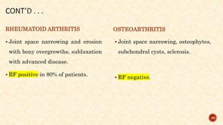 RHEUMATOID ARTHRITIS
 Joint space narrowing and erosion
with bony overgrowths, subluxation
with advanced disease.
 RF positive in 80% of patients.
OSTEOARTHRITIS
 Joint space narrowing, osteophytes,
subchondral cysts, sclerosis.
 RF negative.
49
 