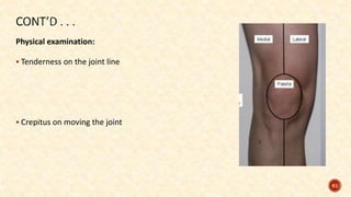 Physical examination:
 Tenderness on the joint line
 Crepitus on moving the joint
61
 