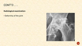 Radiological examination:
 Deformity of the joint
64
 