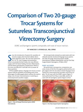 COVER STORY



Comparison of Two 20-gauge
    Trocar Systems for
Sutureless Transconjunctival
    Vitrectomy Surgery
            DORC and Synergetics systems comparable, with ease of trocar insertion.
                                   BY NARCISO F. ATIENZA JR., MD, DPBO


       ince the introduction of systems for sutureless vit-      We retrospectively reviewed our early results with two


S      rectomy surgery, there has been debate about
       which approach is best. We now have options for
       20-, 23-, 25-, and 27-gauge instrumentation.
Which can provide the best results: the most efficient
surgery with the fastest healing, the least inflammation,
                                                              relatively recently introduced 20-gauge trocar systems:
                                                              the Claes 20 Gauge Vitrectomy System (DORC
                                                              International, Zuidland, Netherlands), and the One-Step
                                                              Surgical System (Synergetics, O’Fallon, MO).1

and the fewest postoperative complications? Which is          FIR ST 40 C A SE S
the most cost-effective? It will take time to answer all        We performed a retrospective, comparative case
these questions.                                              series review of the first 40 surgeries performed by a sin-
  Of the available options, 20-gauge non-trocar or trocar     gle surgeon with the two above-named 20-gauge trocar
systems hold the possibility of providing some of the         systems for transconjunctival sutureless vitrectomy sur-
advantages of smaller-gauge systems without the need to       gery. The 40 cases with the DORC system (Figure 1)
adopt a lot of newer instrumentation in switching to          were performed from May to July 2008, and the 40
transconjunctival sutureless surgery.                         cases with the Synergetics system (Figure 2) from




Figure 1. Claes 20 Gauge Vitrectomy System (DORC
International).                                               Figure 2. One-Step Surgical System (Synergetics).


                                                                                      JANUARY/FEBRUARY 2010 I RETINA TODAY I 1
 