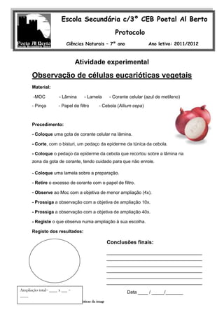 Escola Secundária c/3º CEB Poetal Al Berto
                                                         Protocolo
                           Ciências Naturais – 7º ano                        Ano letivo: 2011/2012



                                Atividade experimental
                        Nome: _______________________
                                                   nº ____                             Turma ____


      Observação de Felismina R. Covas
             Professora: células eucarióticas vegetais

      Material:

       -MOC           - Lâmina        - Lamela        - Corante celular (azul de metileno)
      - Pinça         - Papel de filtro        - Cebola (Allium cepa)



      Procedimento:

      - Coloque uma gota de corante celular na lâmina.

      - Corte, com o bisturi, um pedaço da epiderme da túnica da cebola.

      - Coloque o pedaço da epiderme da cebola que recortou sobre a lâmina na
      zona da gota de corante, tendo cuidado para que não enrole.

      - Coloque uma lamela sobre a preparação.

      - Retire o excesso de corante com o papel de filtro.

      - Observe ao Moc com a objetiva de menor ampliação (4x).

      - Prossiga a observação com a objetiva de ampliação 10x.

      - Prossiga a observação com a objetiva de ampliação 40x.

      - Registe o que observa numa ampliação à sua escolha.

      Registo dos resultados:

                                                    Conclusões finais:
                                                    ______________________________________
                                                    ______________________________________
                                                    ______________________________________
                                                    ______________________________________
                                                    ______________________________________
                                                    ______________________________________
Ampliação total= ____ x ___ =
                                                                  Data ____ / _____/_______
____
      Atividade experimental - características da imagem ao MOC       7º ano - Ciências Experimentias
 