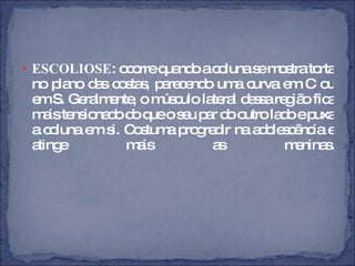 ESCOLIOSE : ocorre quando a coluna se mostra torta no plano das costas, parecendo uma curva em C ou em S. Geralmente, o músculo lateral dessa região fica mais tensionado do que o seu par do outro lado e puxa a coluna em si. Costuma progredir na adolescência e atinge mais as meninas. 