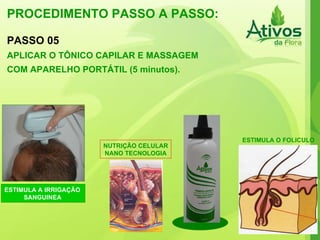 PROCEDIMENTO PASSO A PASSO: ESTIMULA O FOLICULO ESTIMULA A IRRIGAÇÃO SANGUINEA PASSO 05 APLICAR O TÔNICO CAPILAR E MASSAGEM COM APARELHO PORTÁTIL (5 minutos). NUTRIÇÃO CELULAR NANO TECNOLOGIA 