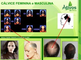 CÁLVICE FEMININA e MASCULINA RESULTADOS TERAPIA ATIVOS DA FLORA 