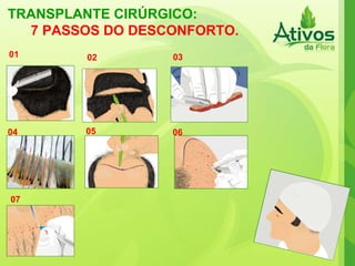 TRANSPLANTE CIRÚRGICO: 7 PASSOS DO DESCONFORTO. 01 03 02 06 04 05 07 