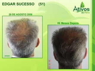 EDGAR SUCESSO  (51) 28/08/08 06 Meses Depois 28 DE AGOSTO 2008 